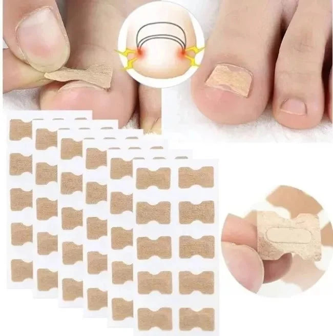 Parches Antihongo Y Uñas Encarnadas