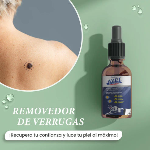 Removedor Verrugas