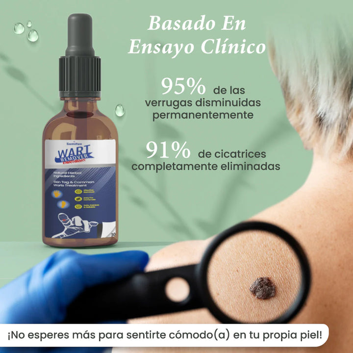 Removedor Verrugas